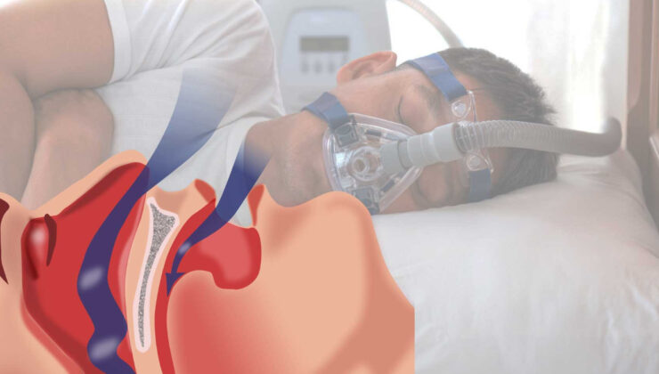 Uzmanlardan bayram dönüş yolunda ‘uyku apnesi’ uyarısı