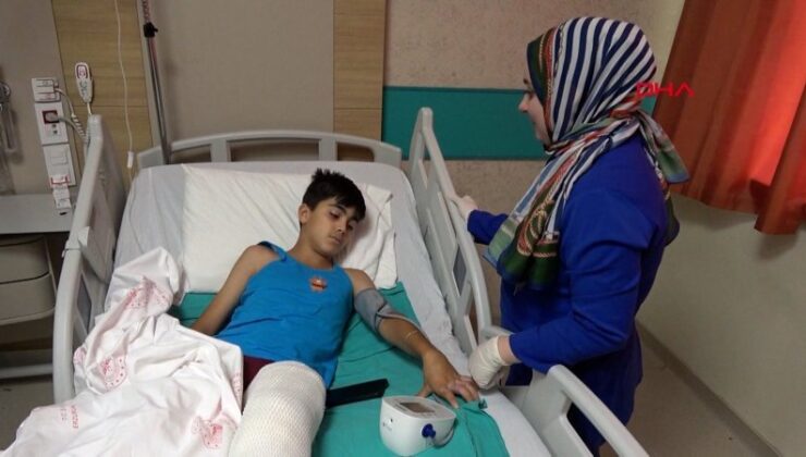 Erzurum’da latife yaparken arkadaşını kolonya ile yaktı