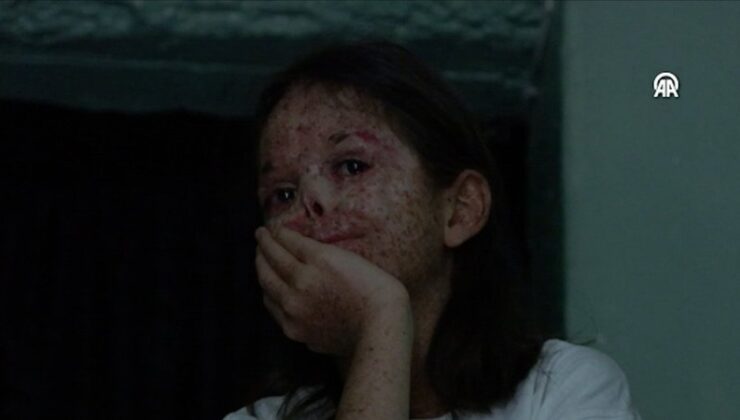 Gaziantep’te güneşe hasret küçük Cemile, kuzenleriyle hayata tutunuyor