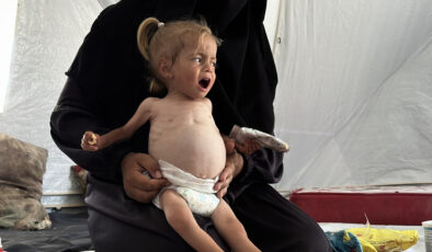 Gazze’de 2 yaşındaki Filistinli bebek ömür çabası veriyor