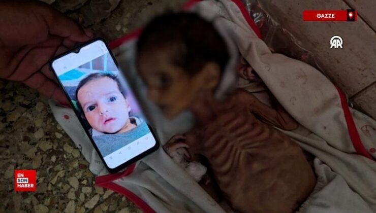 Gazze’de 3 aylık bebek Curi, yetersiz beslenme nedeniyle ömrünü yitirdi