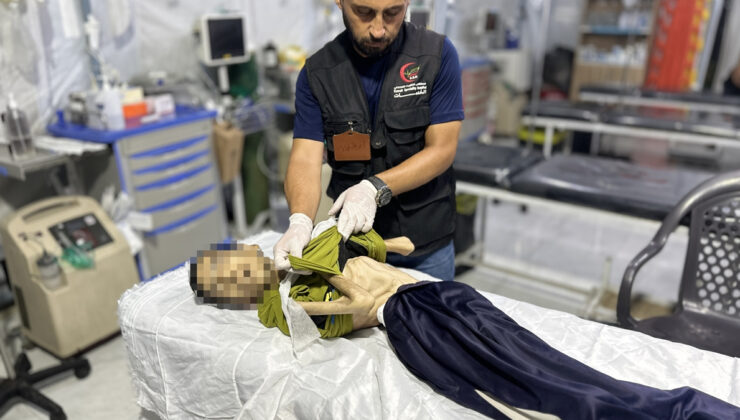 Gazze’de açlık yüzünden beşerler ölüyor