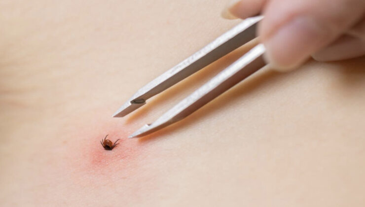 Sivas’ta keneden bir can kaybı daha