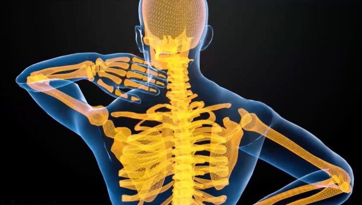 Skolyoz tedavisinde en değerli adım: Erken teşhis