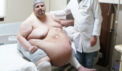 Denizli’de 310 kiloluk hasta sedyede geldiği hastaneden yürüyerek çıktı