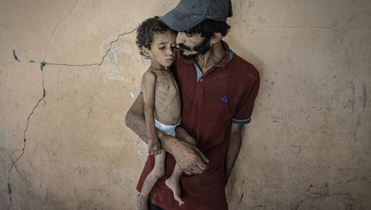 Gazze’de çocuklar açlıkla çaba ediyor