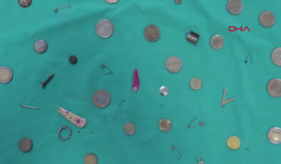 Isparta’da çocukların yuttuğu cisimler doktora koleksiyon oldu