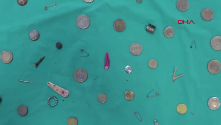 Isparta’da çocukların yuttuğu cisimler doktora koleksiyon oldu