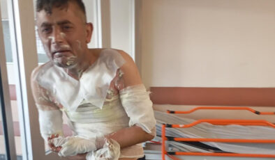 İstanbul’da gasbettiği engelli adam şikayet edince akaryakıt döküp yakmıştı: Yakalandı