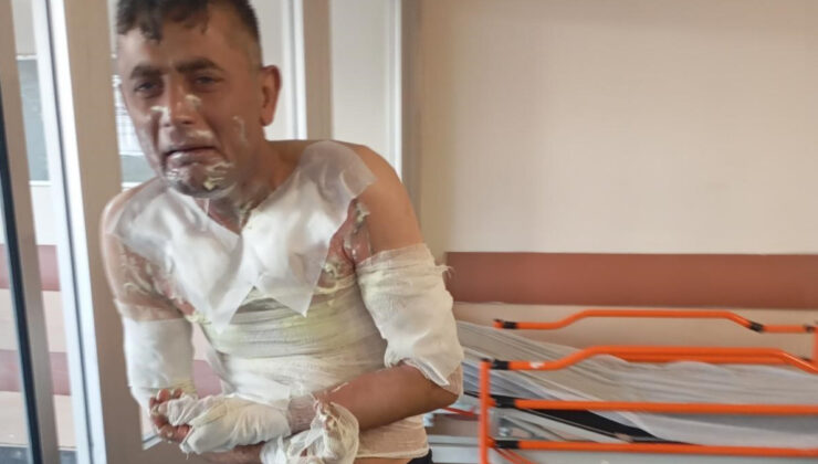 İstanbul’da gasbettiği engelli adam şikayet edince akaryakıt döküp yakmıştı: Yakalandı