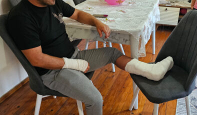 Kastamonu’da sokak köpeğinin saldırısına uğradı: Ayağı iki yerden kırıldı