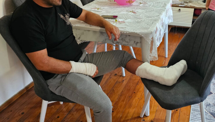 Kastamonu’da sokak köpeğinin saldırısına uğradı: Ayağı iki yerden kırıldı