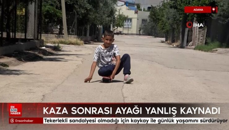 Adana’da kaza sonrası ayağı yanlış kaynadı