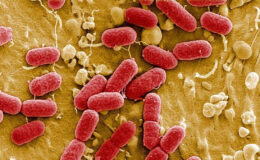 Et yiyen bakteri ABD’de can almaya devam ediyor