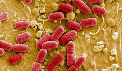 Et yiyen bakteri ABD’de can almaya devam ediyor