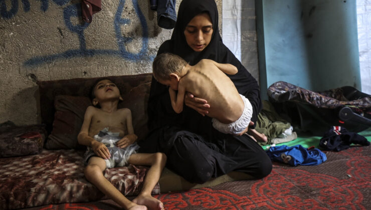 Gazze’de 127 Filistinli açlıktan hayatını kaybetti