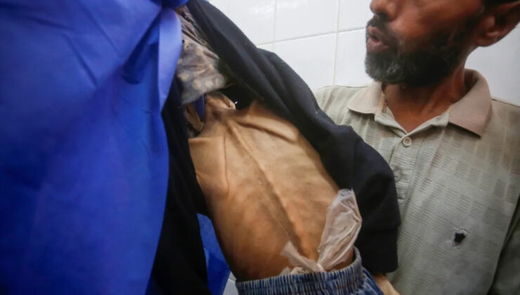 Gazze’de 6 Filistinli açlıktan hayatını kaybetti