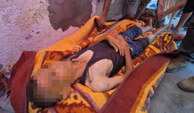 Gazze’de açlık ve yetersiz beslenme can almaya devam ediyor