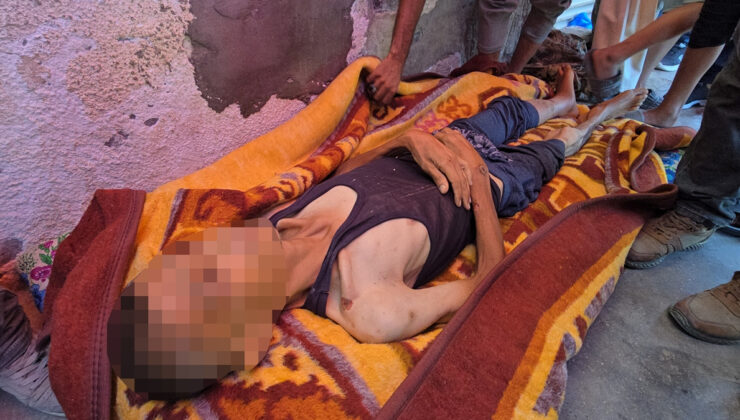 Gazze’de açlık ve yetersiz beslenme can almaya devam ediyor