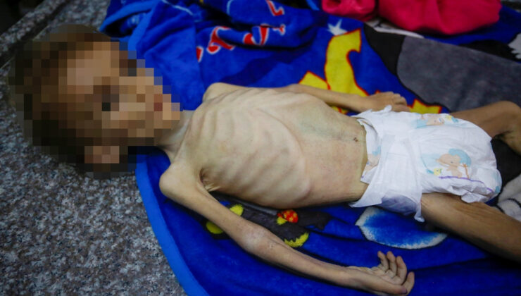 Gazze’de bir bebek daha yetersiz beslenmeden hayatını kaybetti