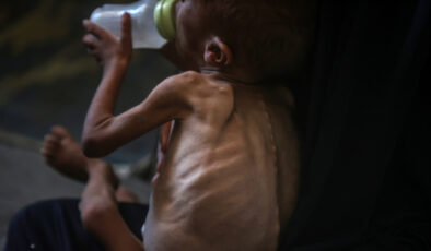 Gazze’de çocuklar açlıktan ölüyor