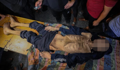 Gazze’de engelli Muhammet yetersiz beslenme nedeniye ömrünü yitirdi