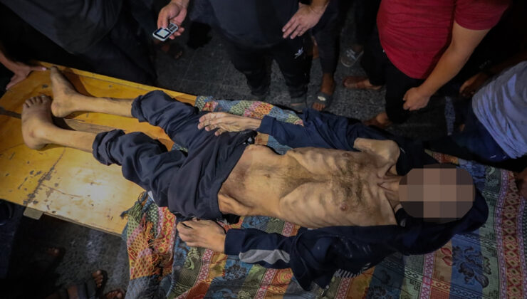 Gazze’de engelli Muhammet yetersiz beslenme nedeniye ömrünü yitirdi