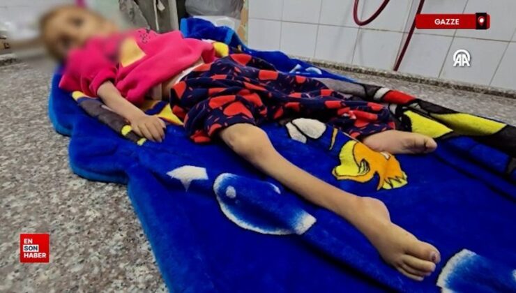 Gazze’de yetersiz beslenme nedeniyle Sena bebek hayatını yitirdi