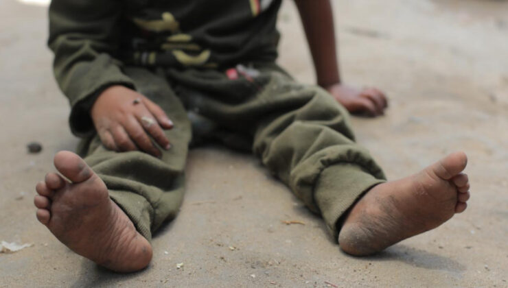 Gazzeli çocukların tedavisini reddeden İngiltere’ye dava