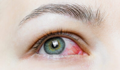 Gözyaşı üretiminin artması hastalıkların habercisi olabilir