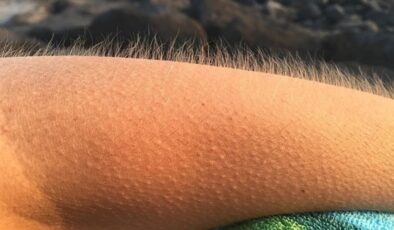 Tüylerin diken diken olmasının nedeni bakın neymiş…