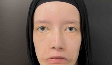 23 Yılı Mimiksiz Geçirdi: Türk Tabiplerin Operasyonuyla Birinci Kere Gülümsedi