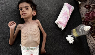 Gazze’de açlıktan vefatlar sürüyor
