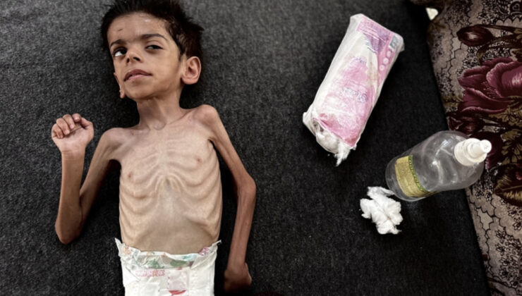 Gazze’de açlıktan vefatlar sürüyor