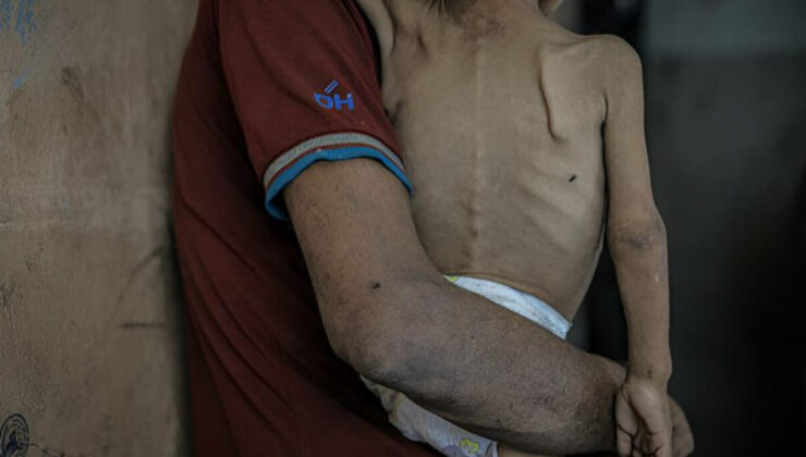 İsrail’in siyasetleri Gazze’de kıtlığı derinleştirdi