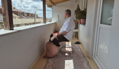 İstanbul’da 15 yıldır fil hastalığıyla gayret eden adam ne yaptıysa deva bulamadı