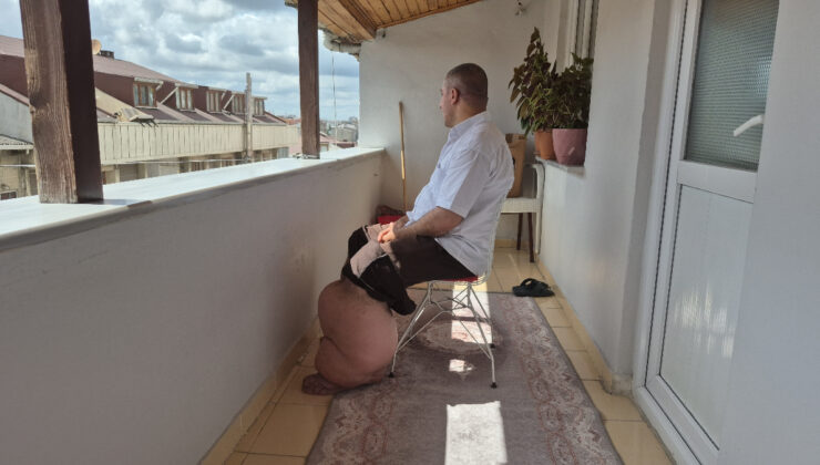 İstanbul’da 15 yıldır fil hastalığıyla gayret eden adam ne yaptıysa deva bulamadı