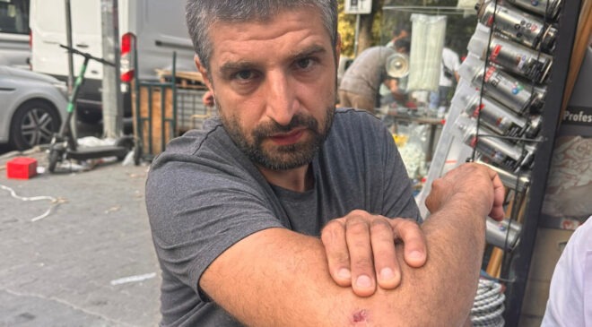 İstanbul’da motosiklet şoförü mevtten döndü