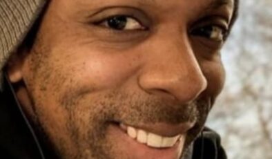 İstanbul’da saç ekimi için gittiği özel klinikte can verdi