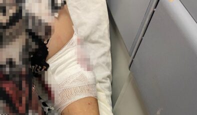 Kocaeli’de abdest almak için bahçeye çıkan bayan köpeklerin saldırısına uğradı