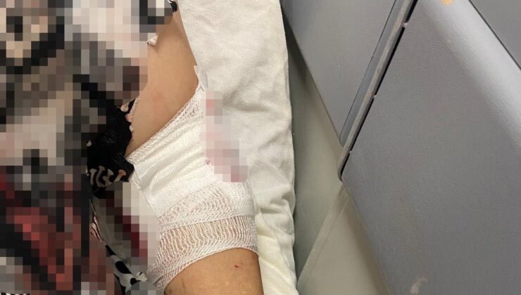 Kocaeli’de abdest almak için bahçeye çıkan bayan köpeklerin saldırısına uğradı