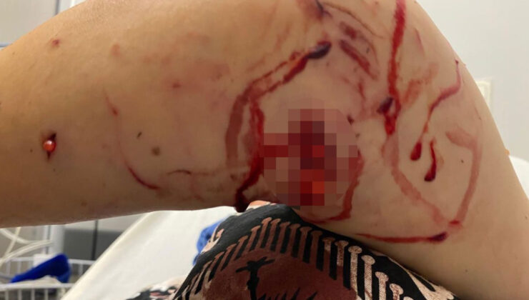 Kocaeli’de başıboş köpek dehşeti: Bayanı parçaladılar