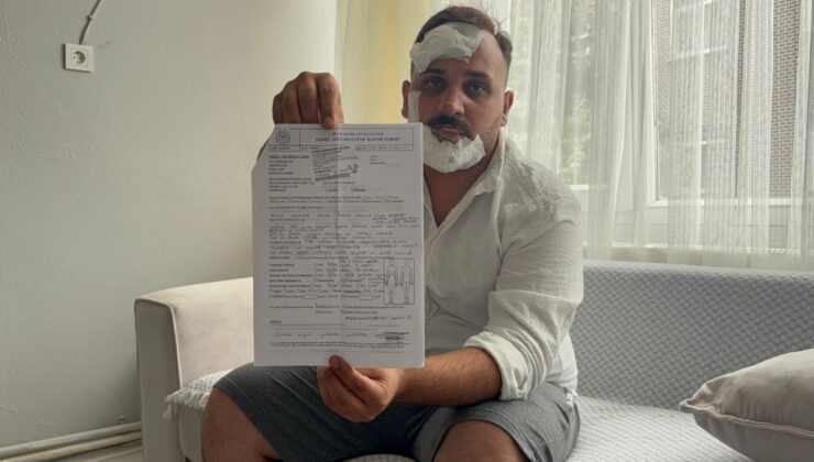 Kocaeli’de taksiciden olay argüman: Eski sözlüm ve ikizinin polis sevgilileri beni dövdü