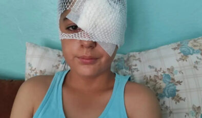 Şanlıurfa’da köpek saldırısından kaçan çocuk yaralandı