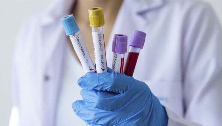 EMA: Hantavirüsün onaylı tedavisi ve aşısı yok